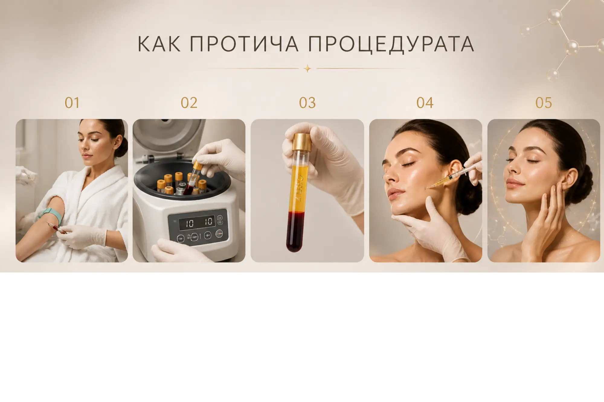 Зони на приложение на плазмолифтинг