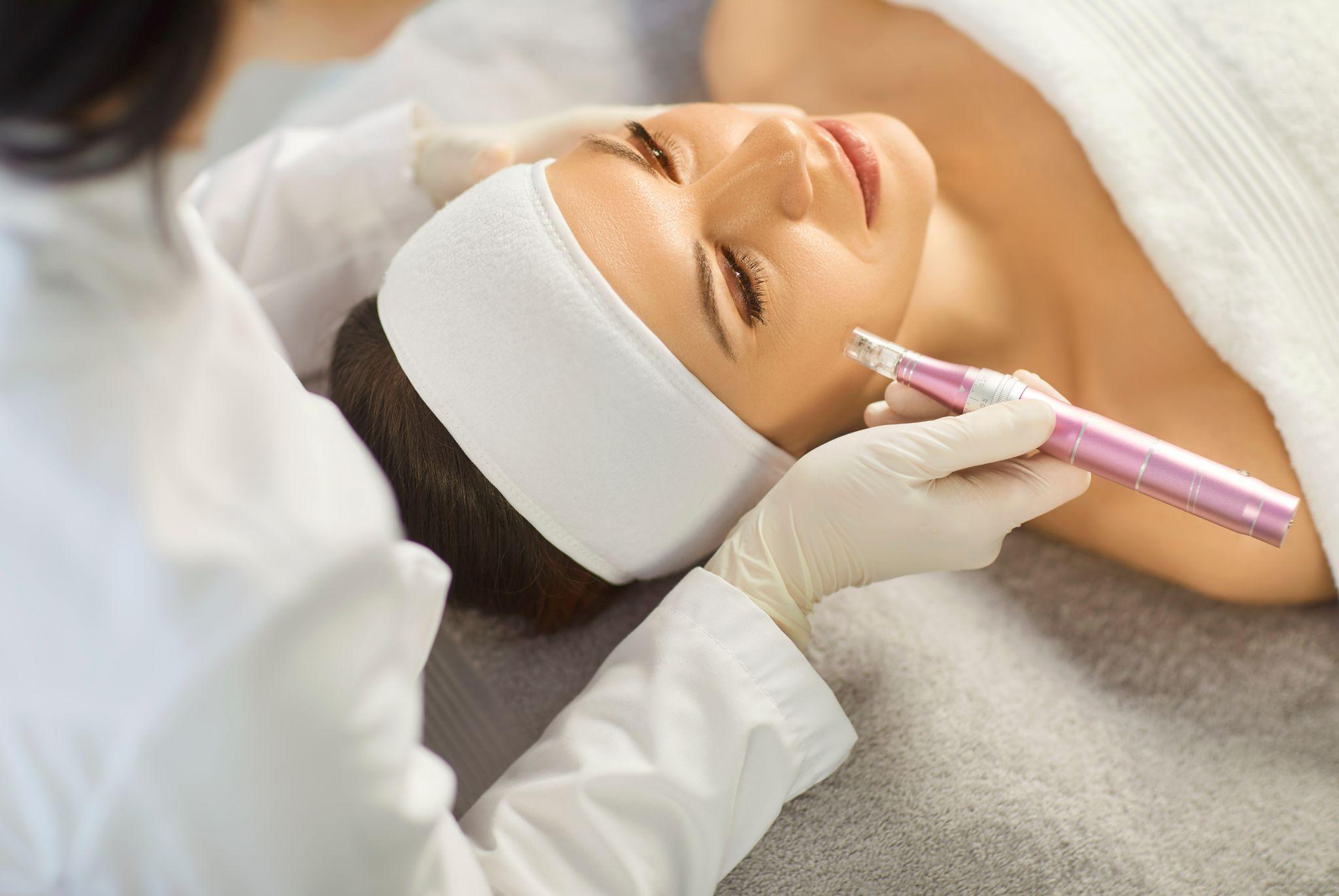 SkinPen процедура